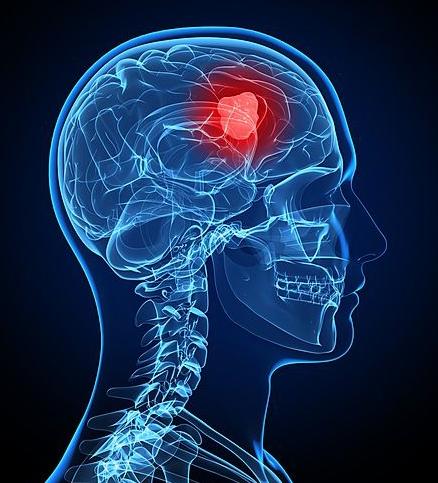 干细胞技术揭秘未来医学崭新篇章，最新内涵解读